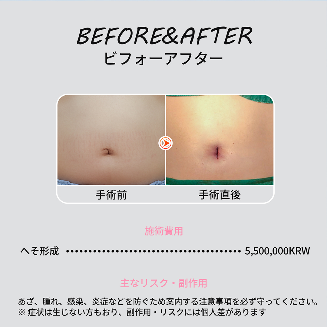 증례 NEW (1)