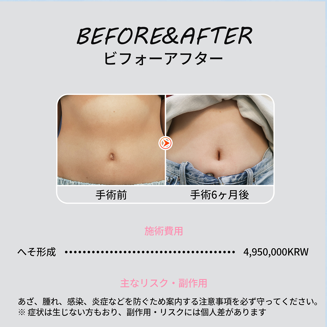 증례 NEW (4)