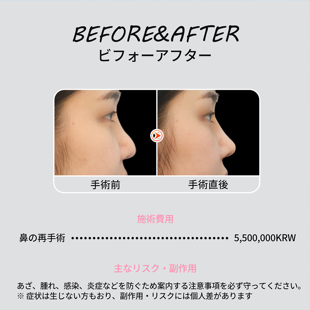 증례 NEW (1)